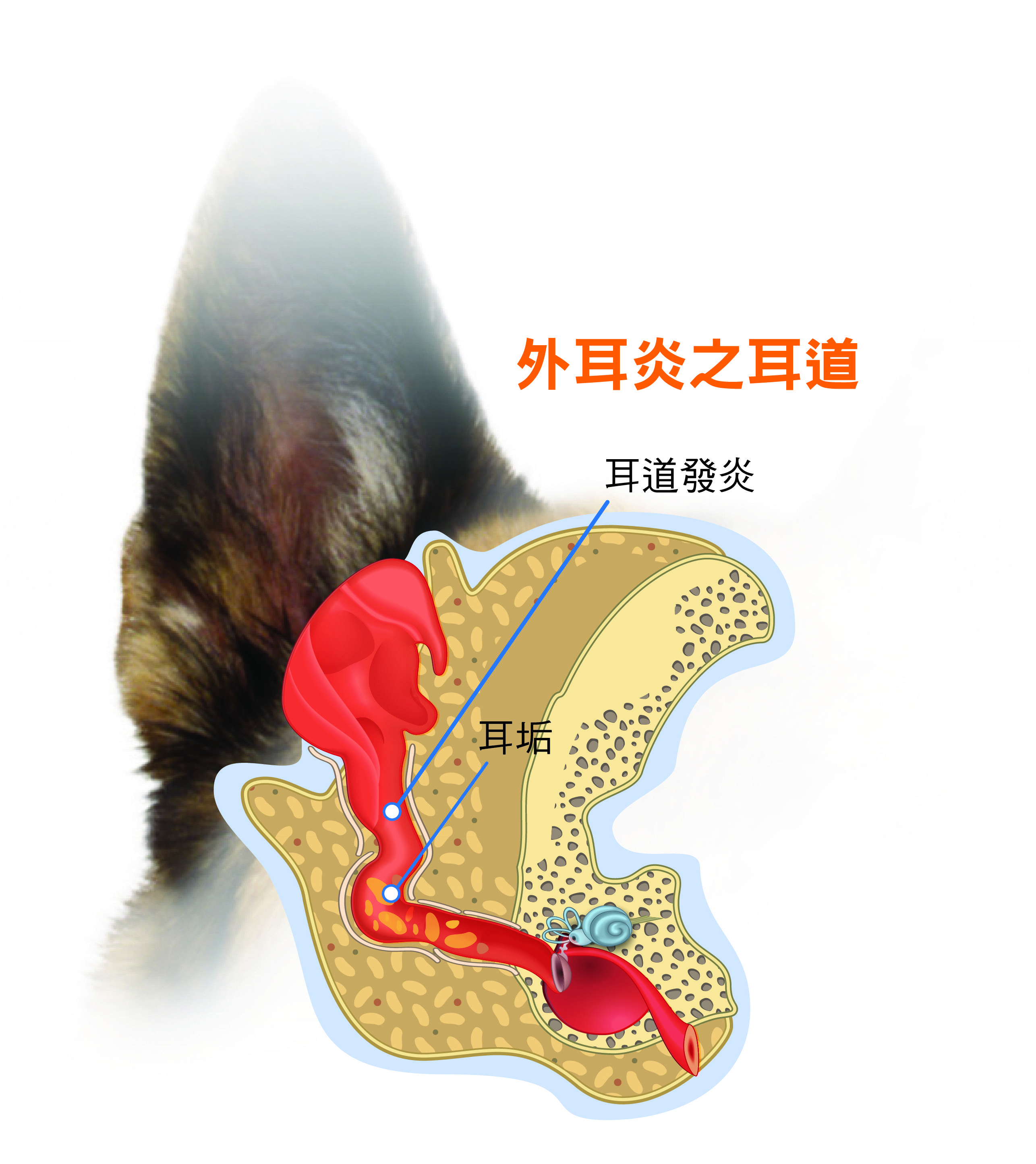 耳道感染圖_2020