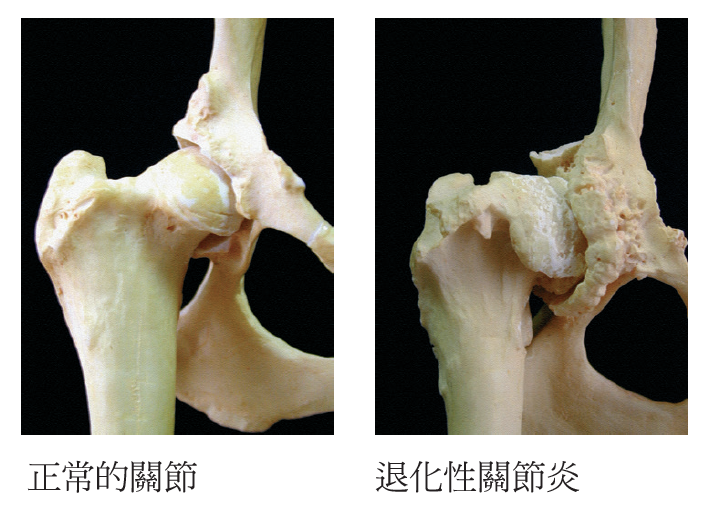 關節骨骼照.PNG